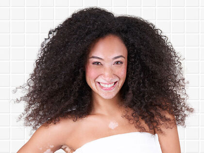 SUN: Schutz im Sommer