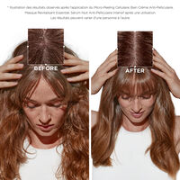Anti-Schuppen-Creme-Shampoo Symbiose