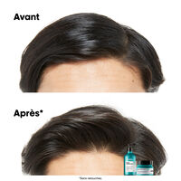 Dermo-reinigendes Anti-Fett-Shampoo Scalp Advanced