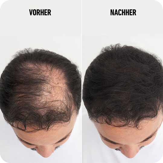 Haarverdichtungsfasern schwarz