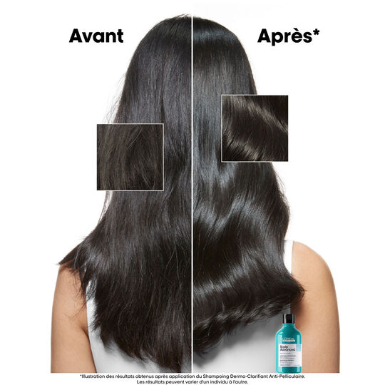 Hautkl&auml;rendes Anti-Schuppen-Shampoo Scalp Advanced 500ml