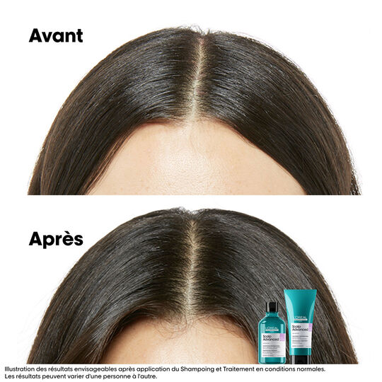 Hautregulierendes Anti-Unwohlsein-Shampoo Scalp Advanced 500ml