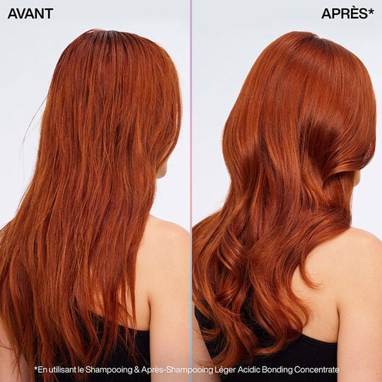 ABC Intensive Treatment Pflegeprogramm f&uuml;r feines Haar