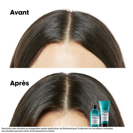 Hautregulierendes Anti-Unwohlsein-Shampoo Scalp Advanced