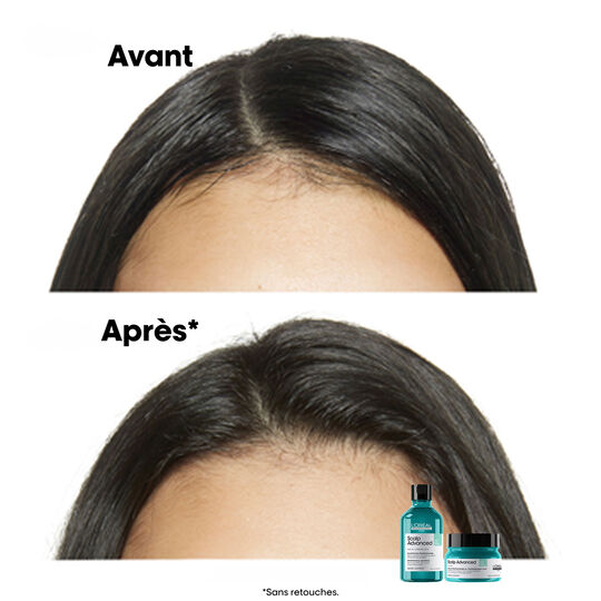 Dermo-reinigendes Anti-Fett-Shampoo Scalp Advanced