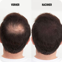 Haarverdichtungsfasern dunkelbraun