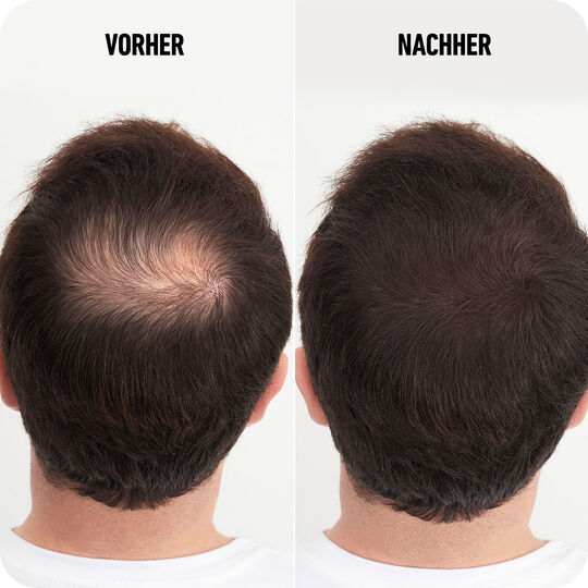 Haarverdichtungsfasern dunkelbraun