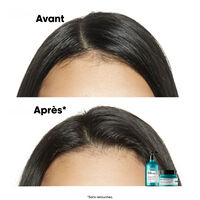 Dermo-reinigendes Anti-Fett-Shampoo Scalp Advanced 500ml