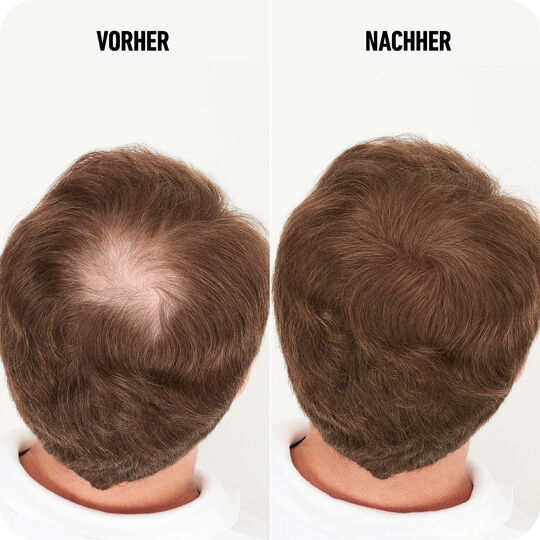 Haarverdichtungsfasern hellbraun