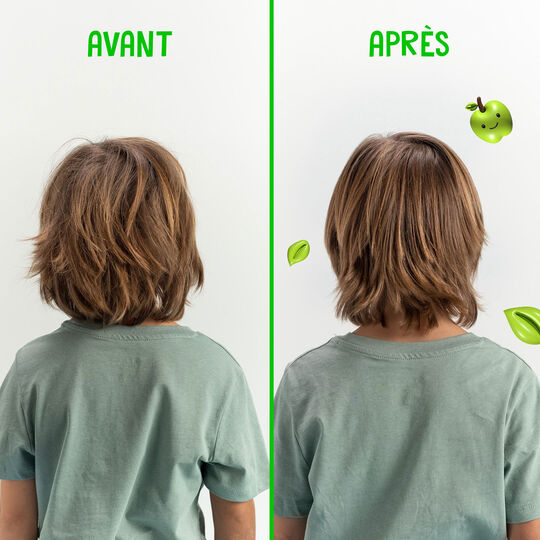 Equave Kids Shampoo & Sp&uuml;lung im Set f&uuml;r Kinder applestastic