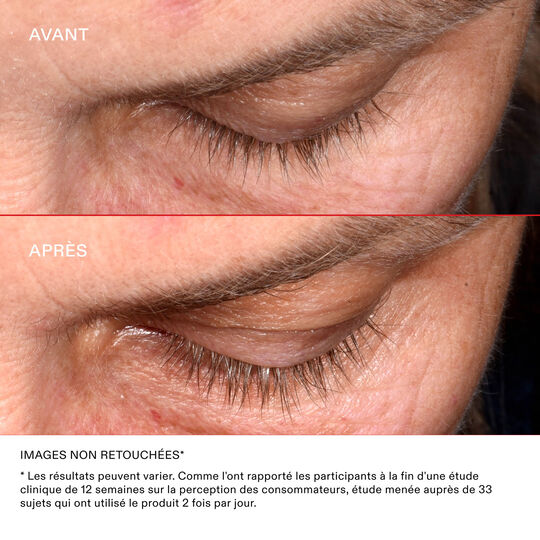 Wimpernwachstumsserum