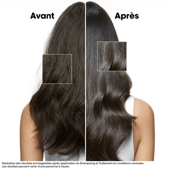 Intensive beruhigende Behandlung Scalp Advanced