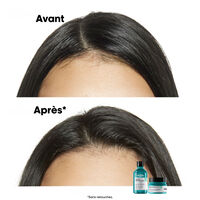 Dermo-reinigendes Anti-Fett-Shampoo Scalp Advanced 300ml