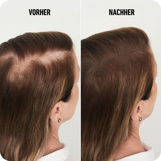 Haarverdichtungsfasern mittelbraun