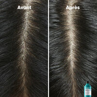 Hautkl&auml;rendes Anti-Schuppen-Shampoo Scalp Advanced
