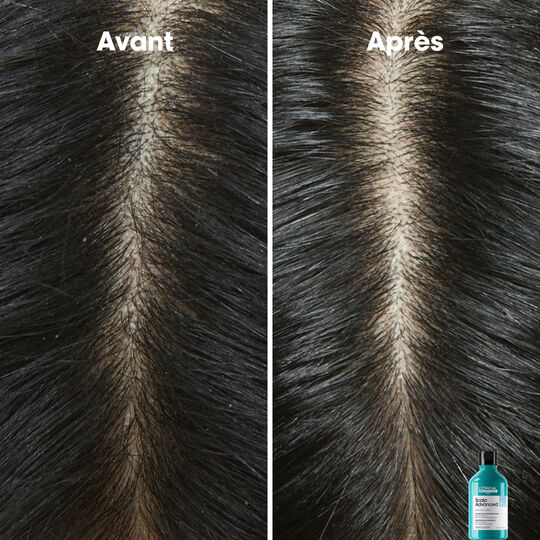 Hautkl&auml;rendes Anti-Schuppen-Shampoo Scalp Advanced