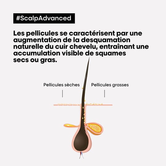 Pflege gegen fettige Schuppen Scalp Advanced