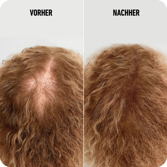 Haarverdichtungsfasern dunkelblond